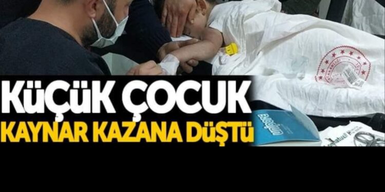 Kaynar kazana düşen çocuk hastanelik oldu